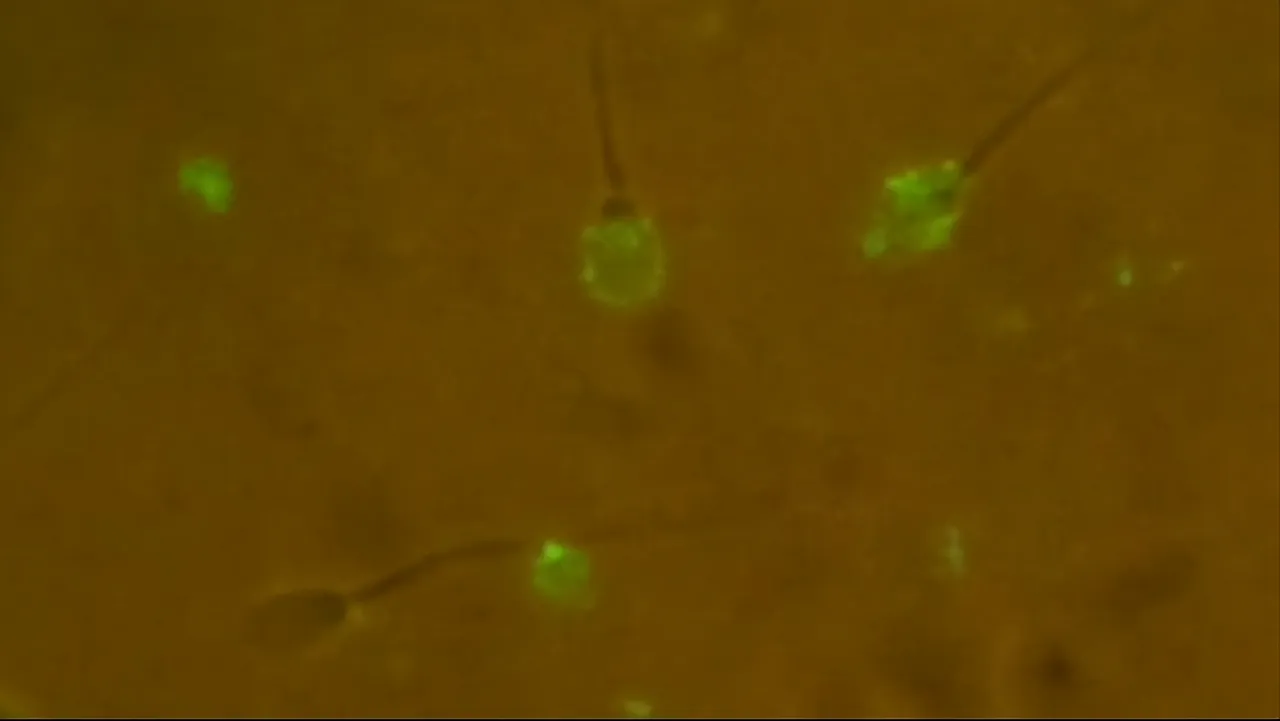 Fluorescent sperm cells